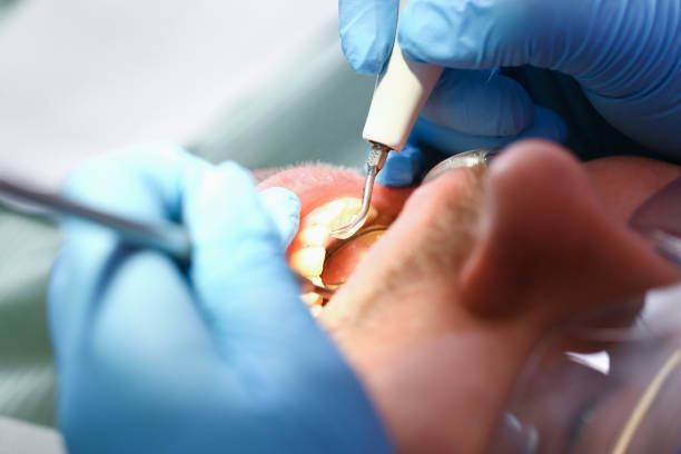 Best Weekend Emergency Dentist in El Verano, CA